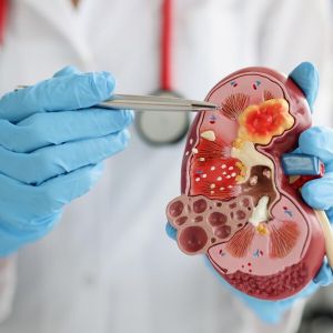 urologista-taguatinga-cncb Urologistqa em Taguatinga DF